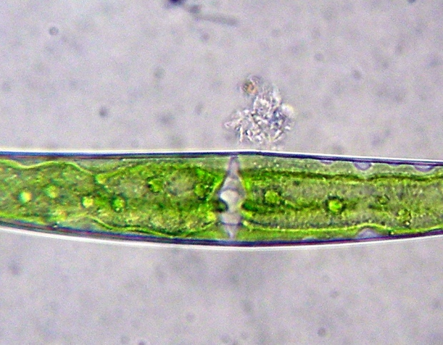 Closterium sp.